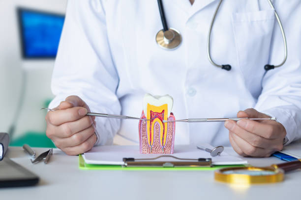 Best Knocked-Out Tooth (Avulsed Tooth) Treatment in Parkwood, CA