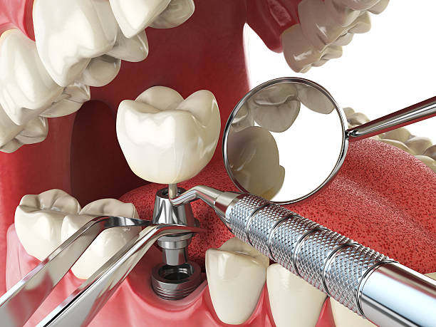 Best Emergency Dental Care for Sports Injuries in Parkwood, CA